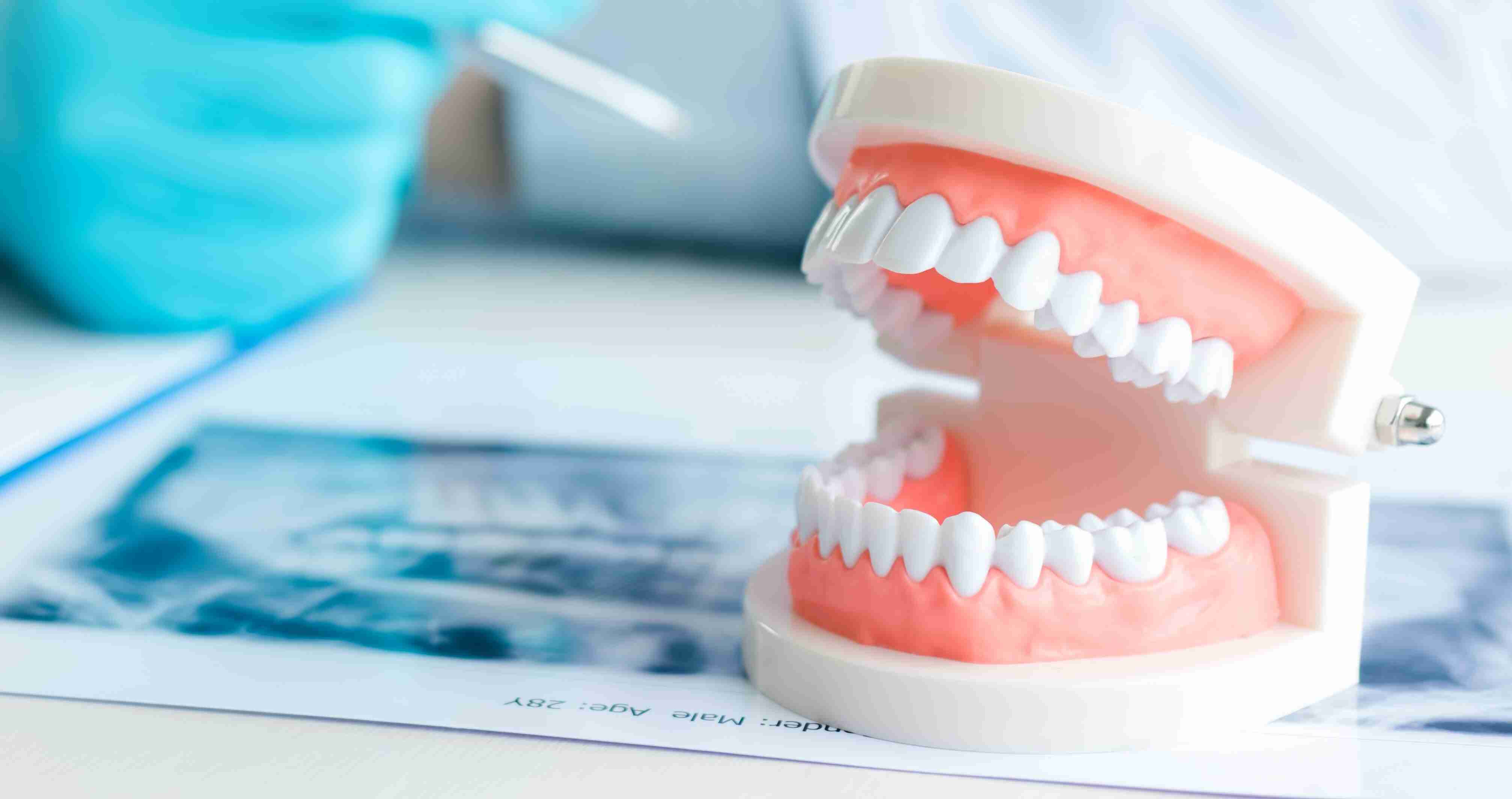 Protetică dentară